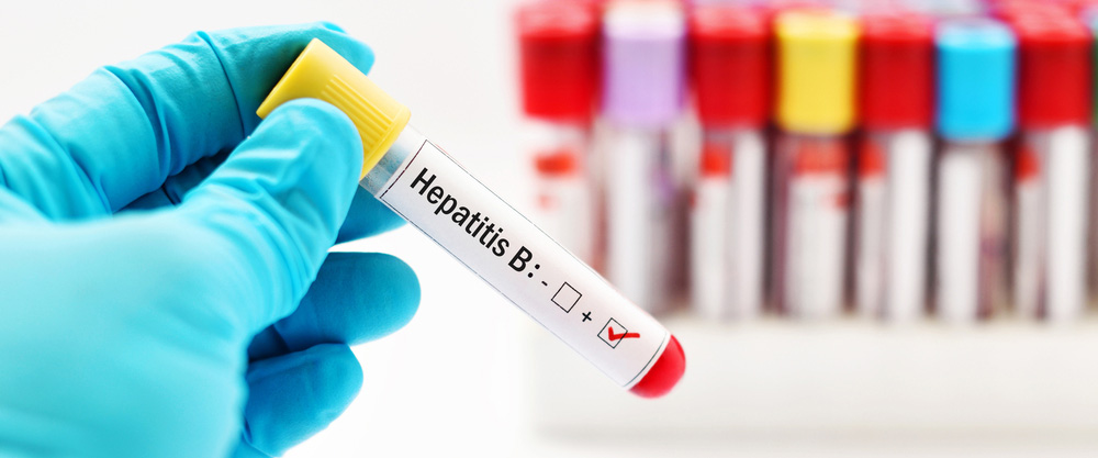 Hepatit B nədir? Semptomlar və müalicə üsulları hansılardır?